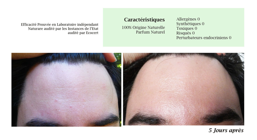 DROP - MERVEILLE DES LANDES BIO - Sensitive skin care Complete regeneration-12
