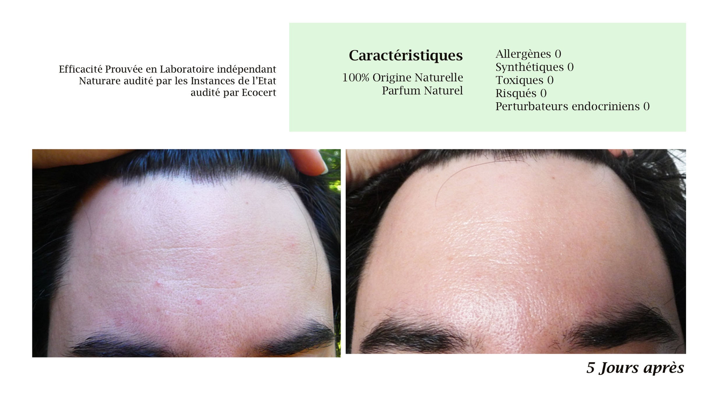 DROP - MERVEILLE DES LANDES BIO - Sensitive skin care Complete regeneration-12