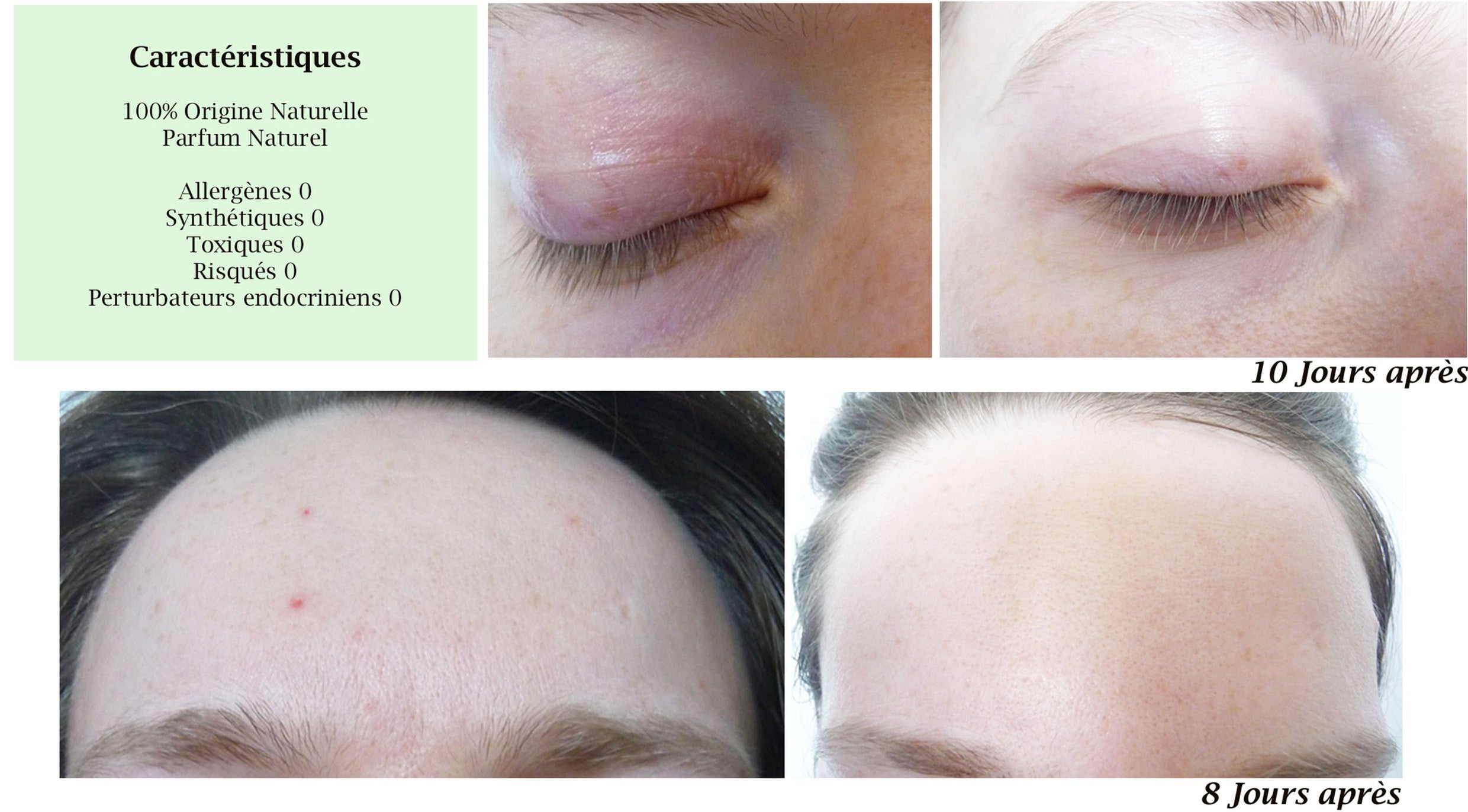 DROP - MERVEILLE DES LANDES BIO - Sensitive skin care Complete regeneration-10