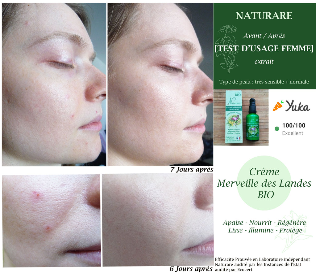 DROP - MERVEILLE DES LANDES BIO - Sensitive skin care Complete regeneration-9